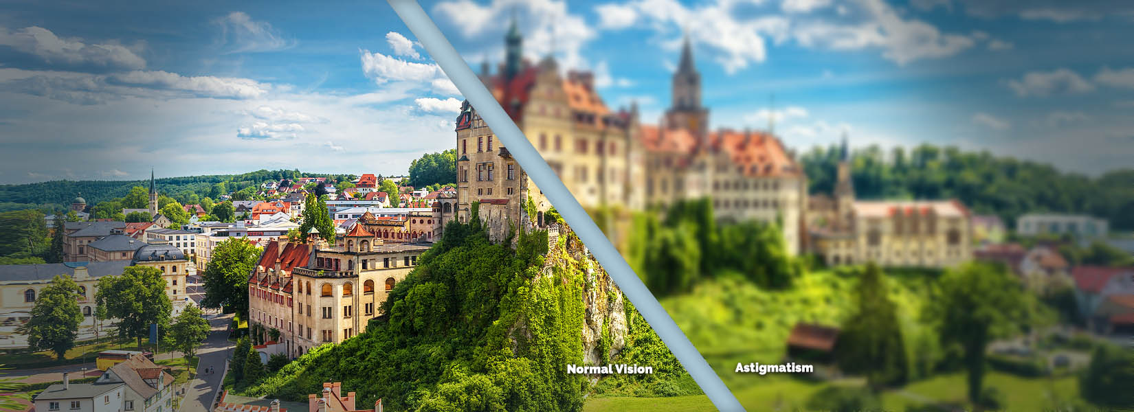Astigmatism Treatment in Omaha